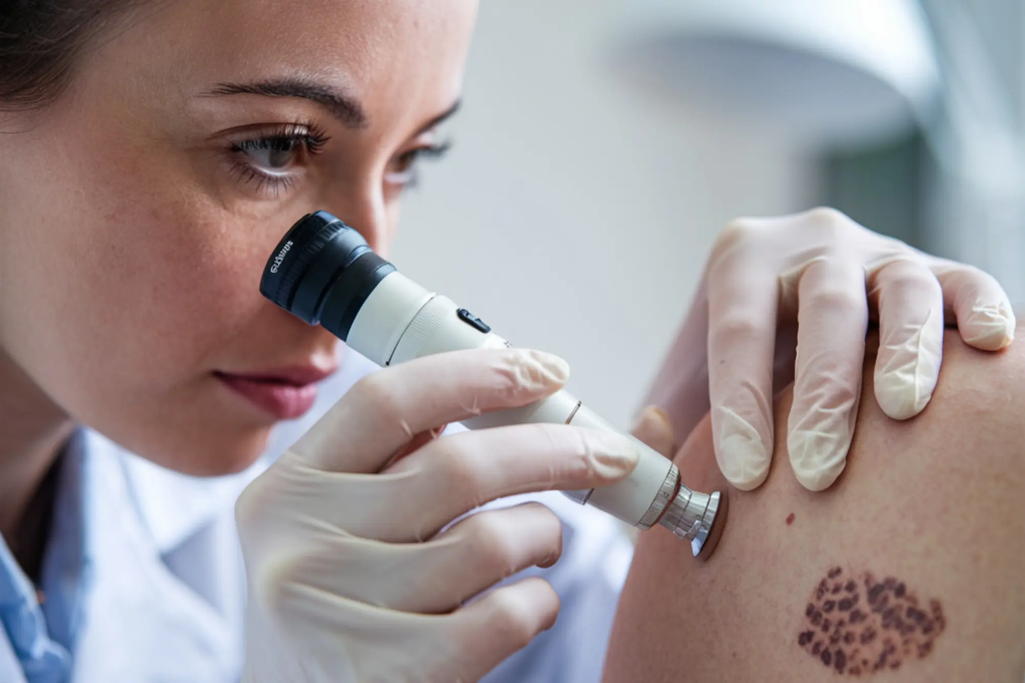 skin treatment